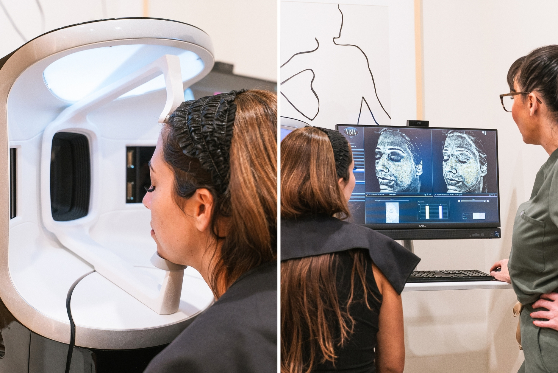 Sachi Ganzak receives a Visia Skin Analysis with Von & Co Aesthetics provider Emily Laeser, APRN.